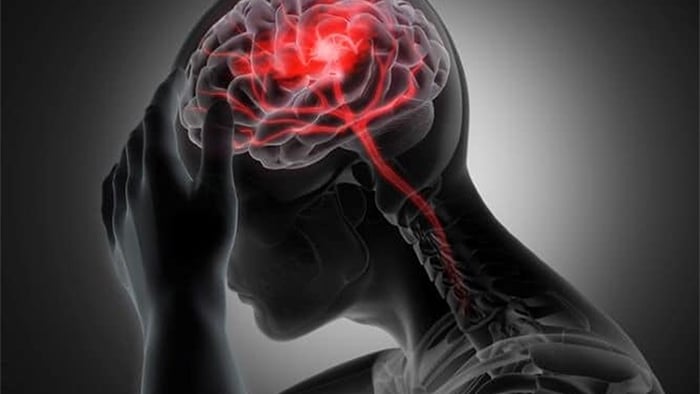 illustration of a brain injury
