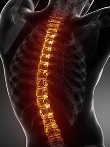 illustration of spinal cord injury