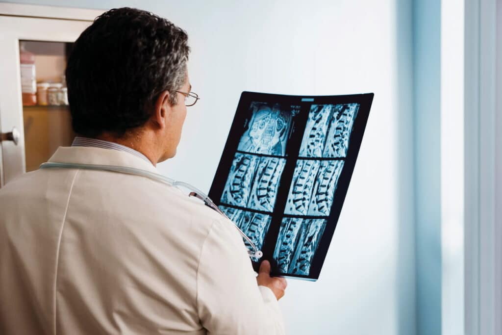 A doctor looks at the X-ray results showing a spinal cord injury.